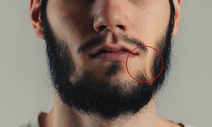 beard wont connect featured image beard wont connect featured image