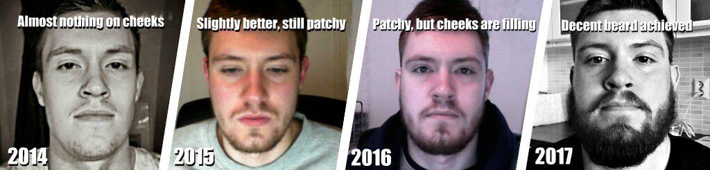 thicker beard journey